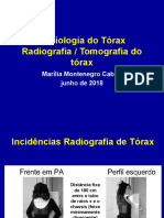 Radiologia do Tórax: Diagnóstico por Imagem