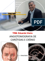 ANGIOTOMOGRAFIA DE CARÓTIDAS E CRÂNIO.pdf
