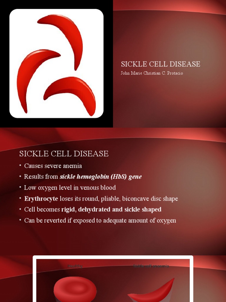 Sickle Cell Disease Overview and Management | PDF | Red Blood Cell | Stroke