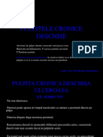 LP Pulpitele Cronice