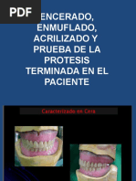 Ganchos Wipla | PDF | Ortodoncia | Boca