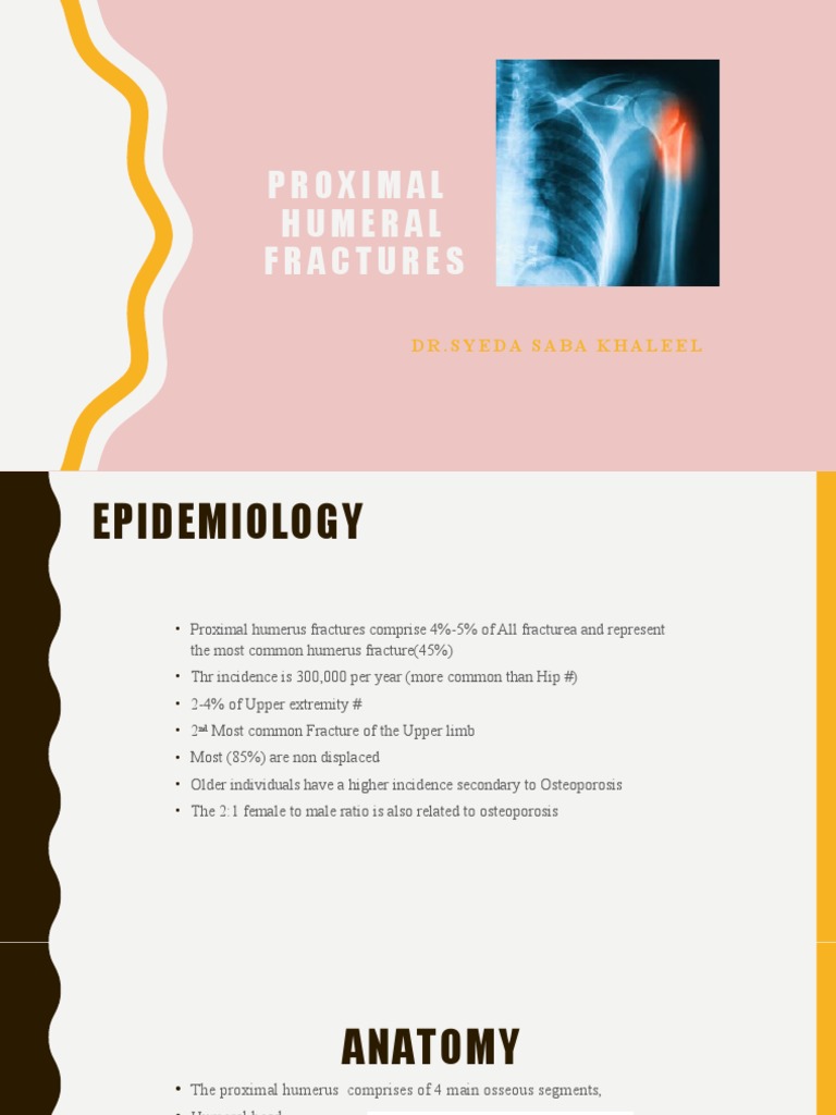 Proximal Humerus Fracture Overview | PDF | Shoulder | Human Anatomy