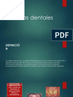 408506297-Carillas-dentales.pdf