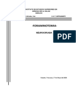 FORAMINOTOMIA