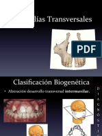 Maloclusiones Transversales PDF