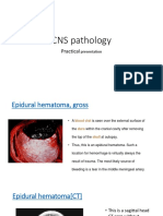 CNS Pathology - Practical