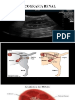 Ecografia Renal