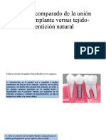 Estudio Comparado de La Unión Tejido-Implante Versus Tejido-Dentición