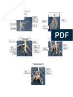Tipos de Raices