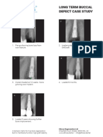 20 Long Term Buccal Defect Case Study PDF