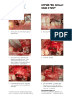 11 Pre Molar Case Study PDF