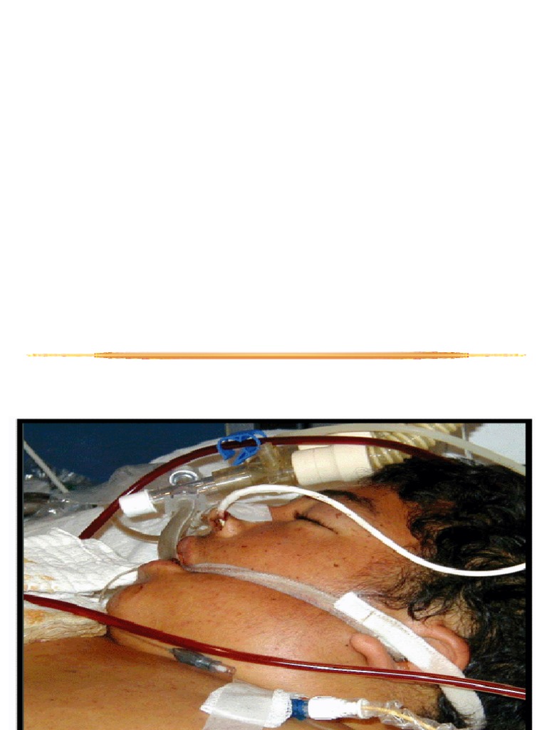 Severe Dengue Prediction and Management | PDF | Shock (Circulatory ...