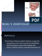 Diverticulum Meckel.ppt