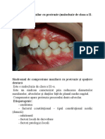 Compresia de Maxilor Cu Protruzie