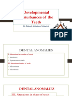 Teeth Developmental Disturbances