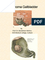 Carcinoma Gallbladder: by Prof. Dr. Banabihari Mishra SCB Medical College, Cuttack