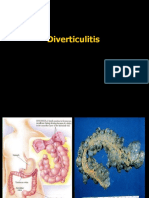 Diverticulitis 100401121737 Phpapp02