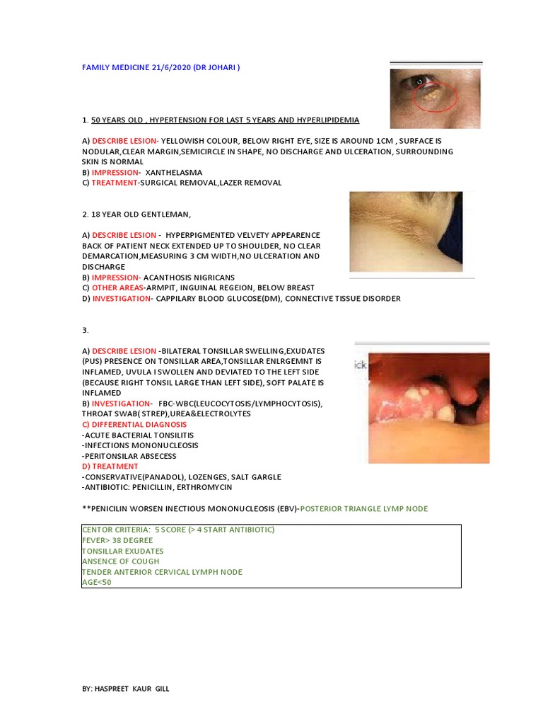 Centor Criteria for Tonsillitis Diagnosis | PDF | Dermatitis ...