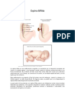 Espina Bífida Embrio