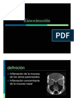 Rinosinusitis