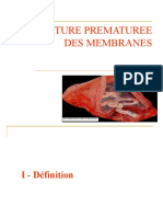 LA RUPTURE PREMATUREE DES MEMBRANES 2013