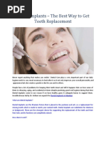 Dental Implants - The Best Way To Get Teeth Replacement