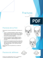 Fracturas PDF