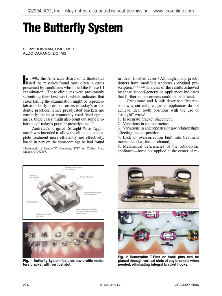 Bracket Butterfly System Orthodontics Dentistry Branches