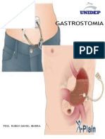 Gastrostomía: qué es, indicaciones y cuidados de enfermería