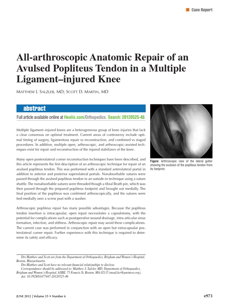 Arthroscopic Repair of Popliteus Tendon | PDF | Knee | Human Anatomy