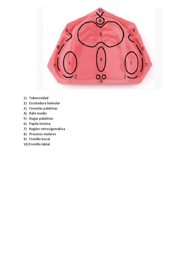 Partes Impresion Edentula | PDF