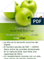 Colelitiasis