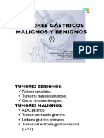 Tumores Gástricos Malignos Y Benignos (I) : Felipe C. Parreño