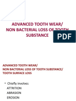 Advanced Tooth Wear/ Non Bacterial Loss of Tooth Substance