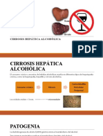 Cirrosis Hepatica Alcoholica