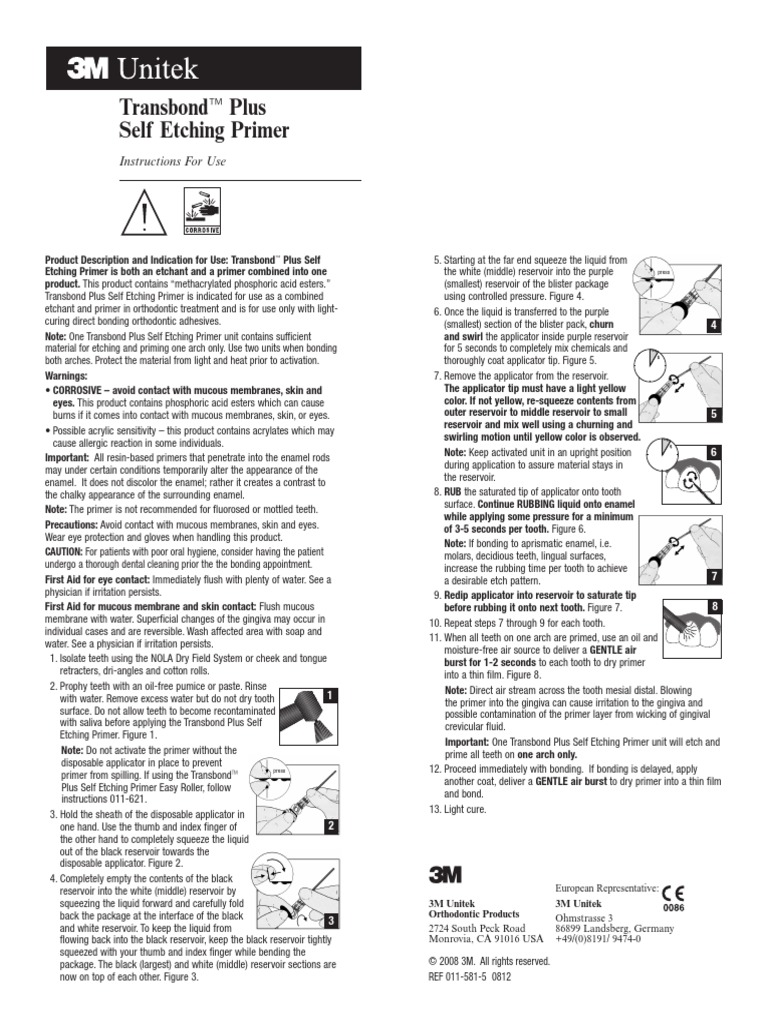 Understanding Self-Etching Primer Drying Time 