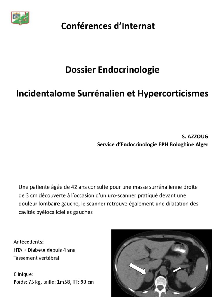 Incidentalome surrénalien et hypercorticisme | PDF | RTT | Anatomie humaine