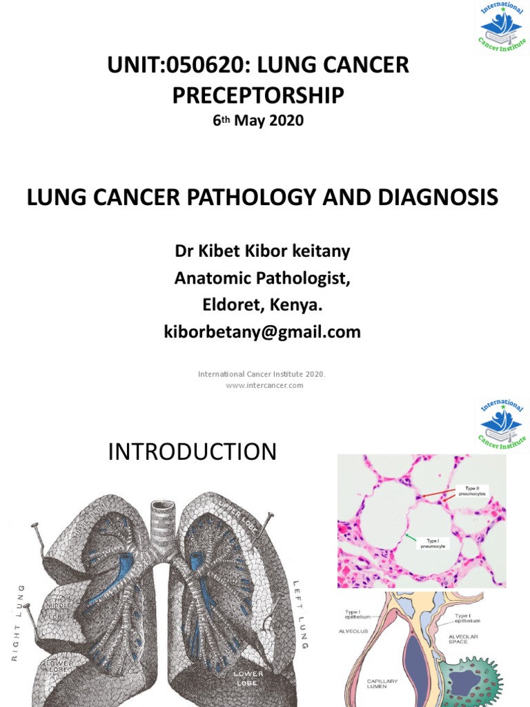 Lung Cancer Pathology and Diagnosis Guide | PDF | Carcinoma | Lung Cancer
