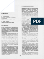 InfartoDeMiocardioYCocaina.pdf