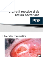 Ulceratii Reactive Si de Natura Bacteriana