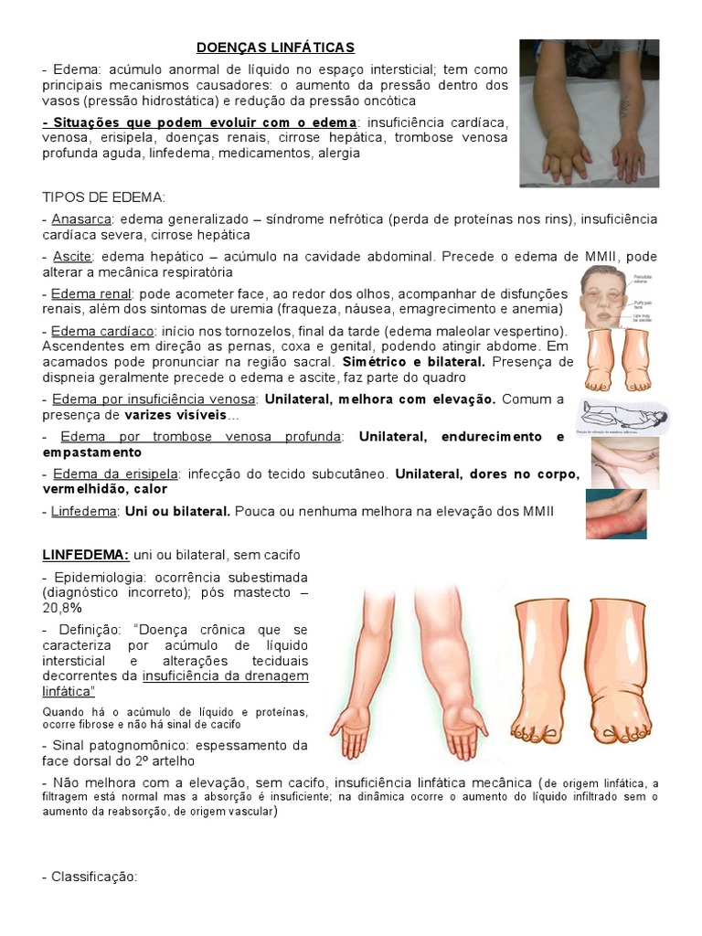 Doenças Linfáticas, PDF, Edema