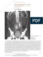 Three Kidneys: Images in Clinical Medicine
