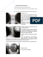 Introduccion Trauma - Robledo