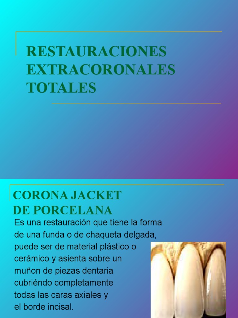 Corona de Porcelana Pura. Materiales – Ventajas – Desventajas