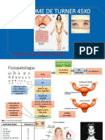 Sindrome de Turner 45XO Terminado PDF