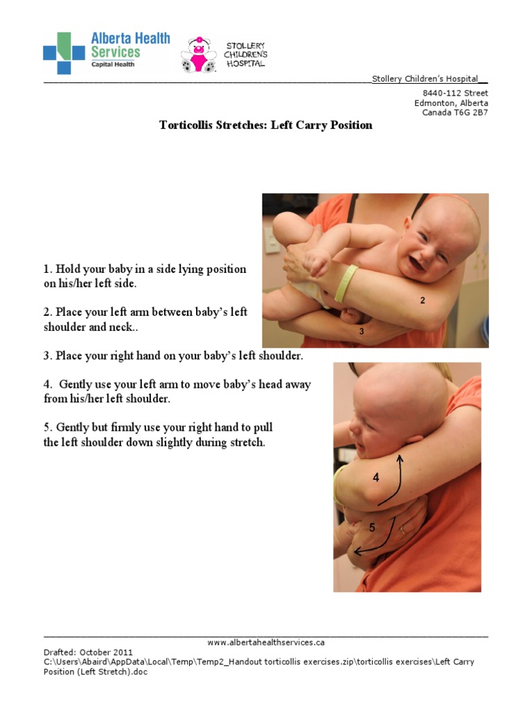 Left Torticollis Baby Exercises Guide | PDF | Anatomical Terms Of ...