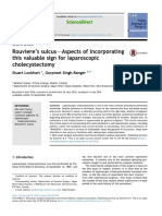 2018 - Rouviere's Sulcus-Aspects of Incorporating This Valuable Sign For Laparoscopic Cholecystectomy