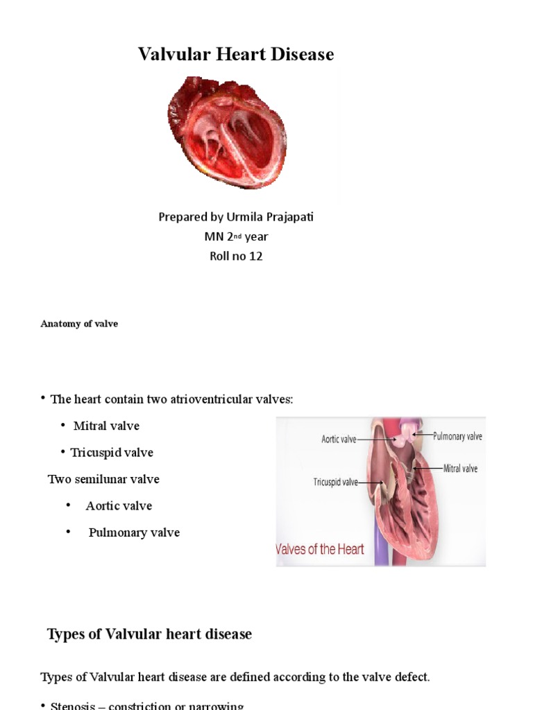 Valvular Heart Disease Pdf Heart Valve Heart
