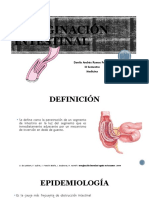 Invaginación Intestinal