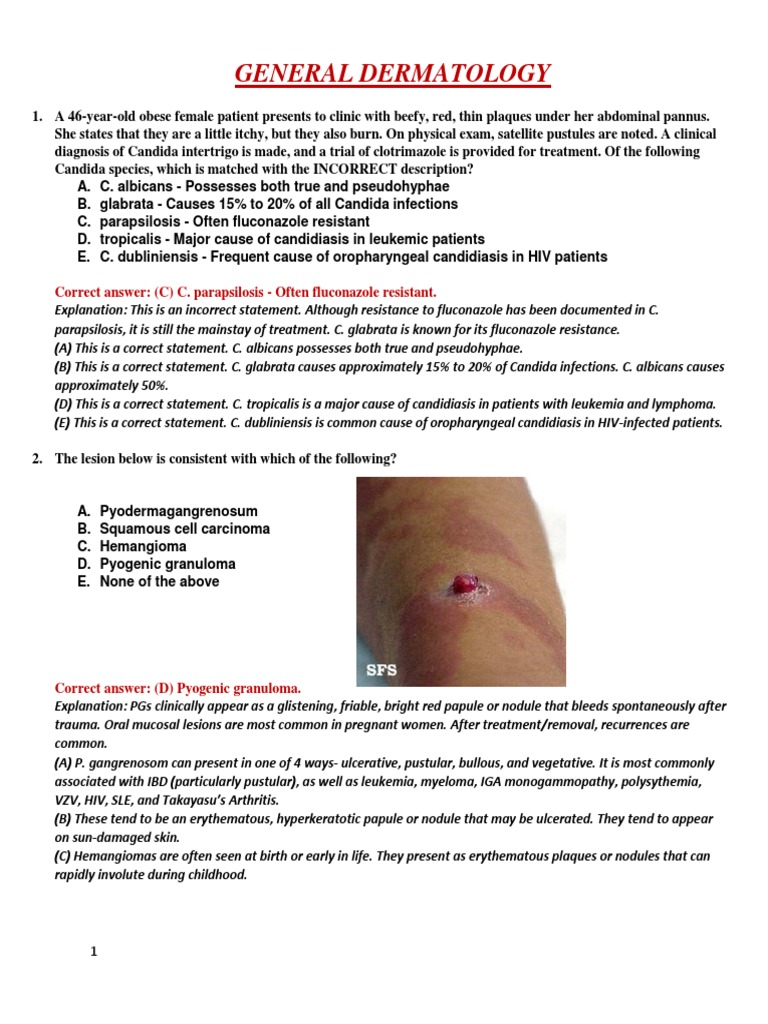 Fluconazole Resistant Candida